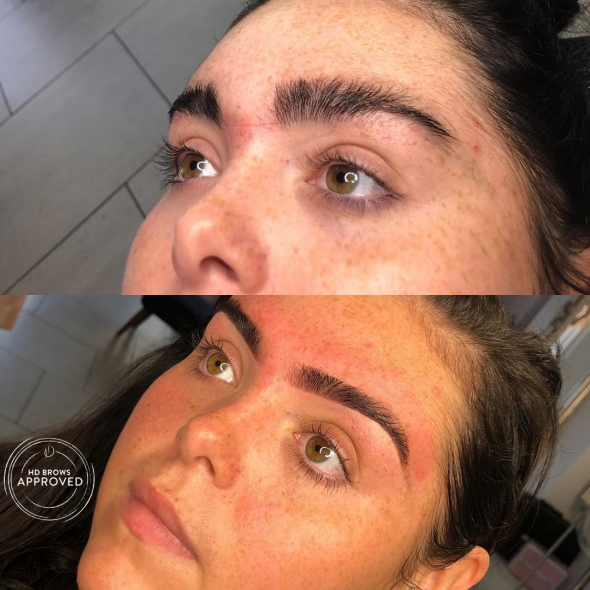 HD brows before and after