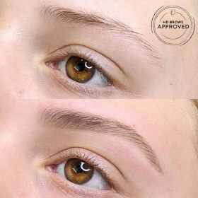 brow treatment before and after